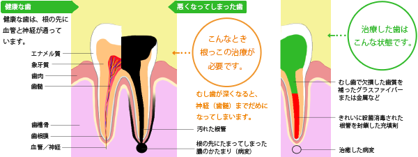 最良かつ最も包括的な 歯 い ー イラスト ガルカヨメ 最良かつ最も包括的な 歯 い ー イラスト ガルカヨメ