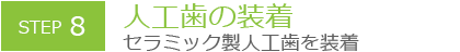 人工歯の装着 セラミック製人工歯を装着