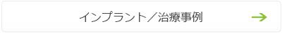 インプラント／治療事例